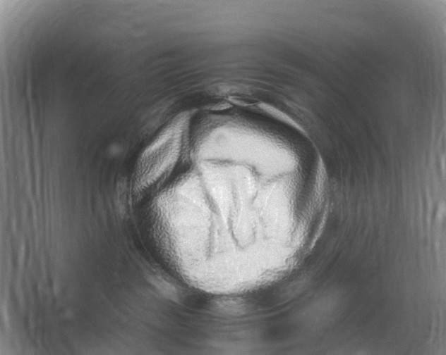 X0000067000189200604142308