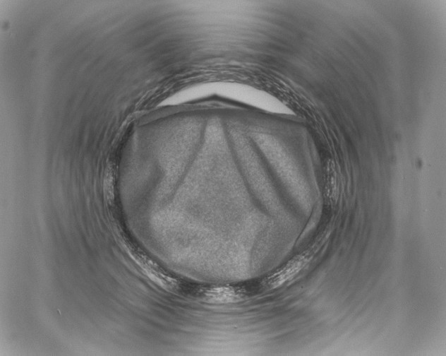 X0000067000562200604241407