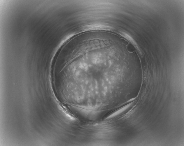 X0000067351043200604071420