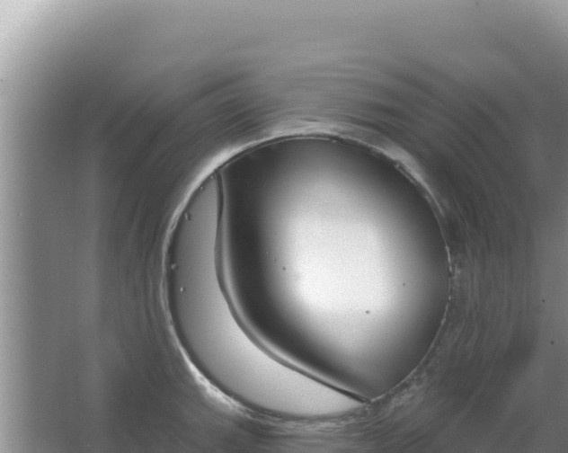 X0000067491143200604150035