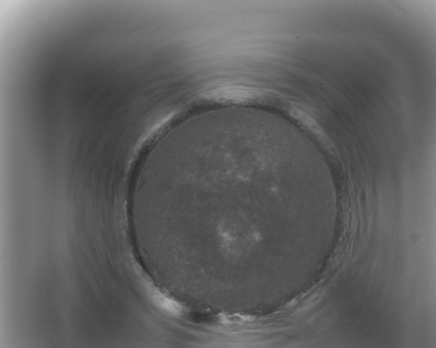 X0000067500399200604150113