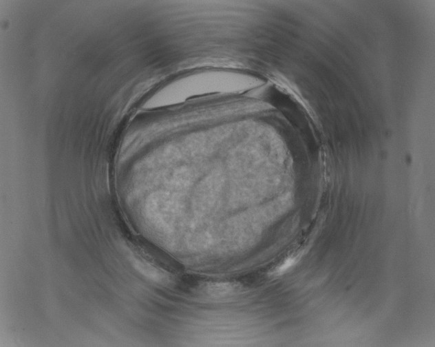 X0000067510205200605051837