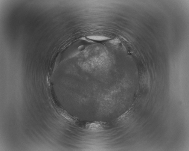 X0000067850180200605041725