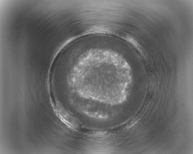 X0000067851038200605041710