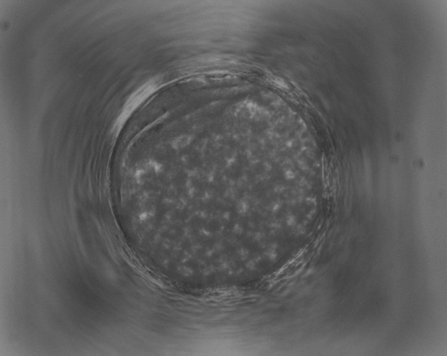 X0000067850099200605111718