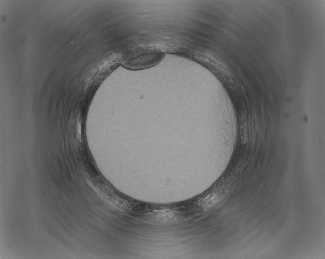 X0000067850310200605111715