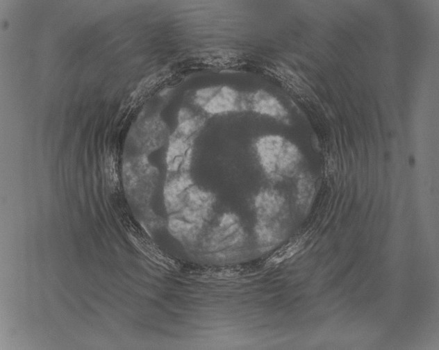 X0000067851106200605111701