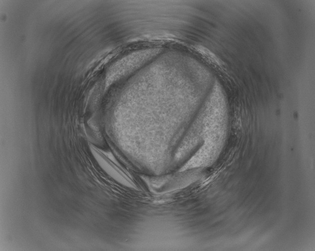 X0000067851110200605111701