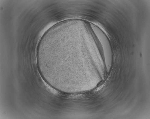 X0000067851143200605111701