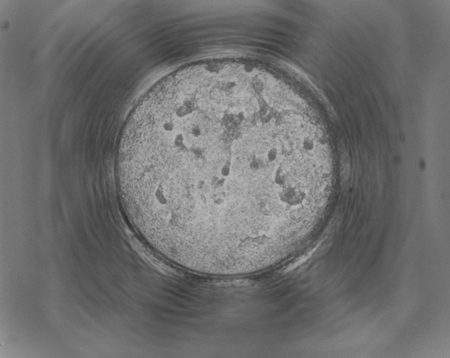 X0000067851417200605111656