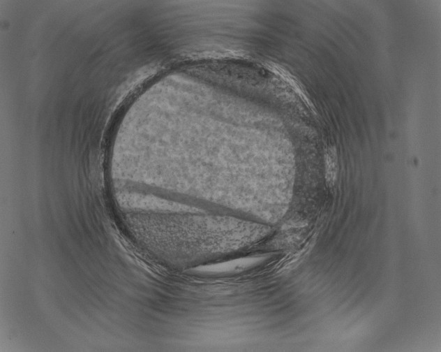 X0000067860395200605111739