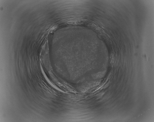 X0000067861202200605111725