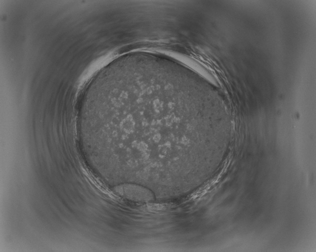 X0000067870149200604201227