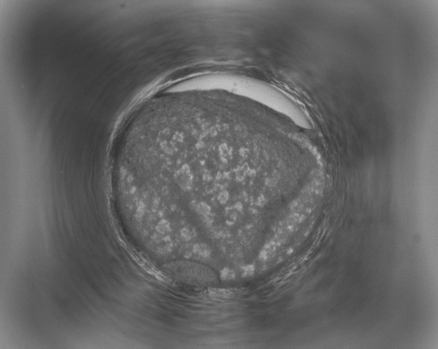 X0000067870149200605041816