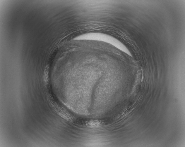 X0000067870600200605041809