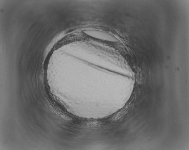 X0000067870152200605111808