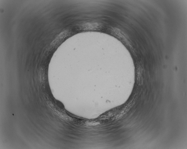 X0000067870257200605111807