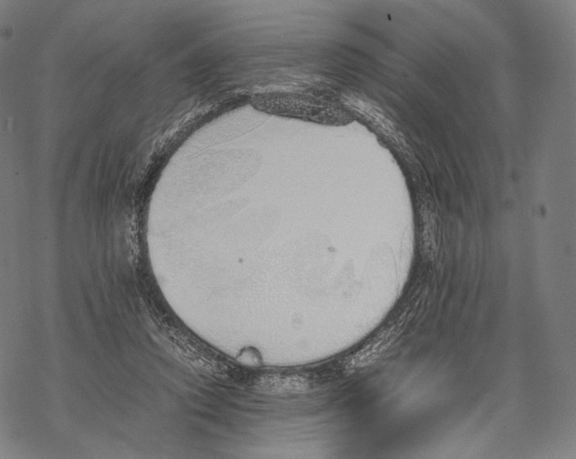 X0000067870354200605111805