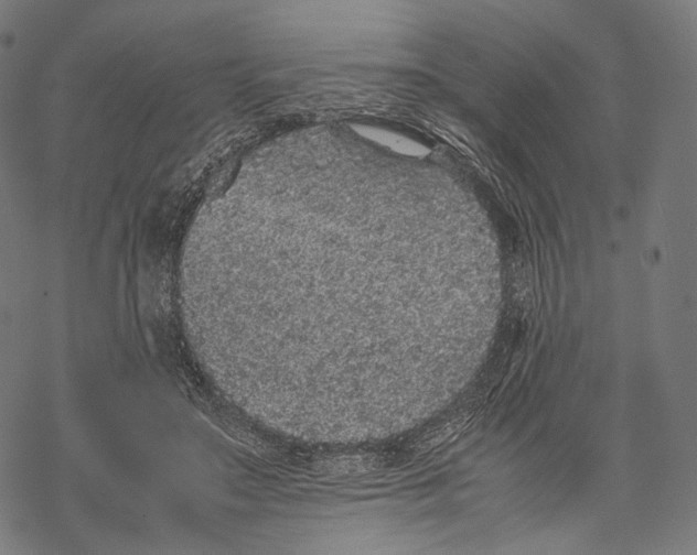 X0000067870499200605111803