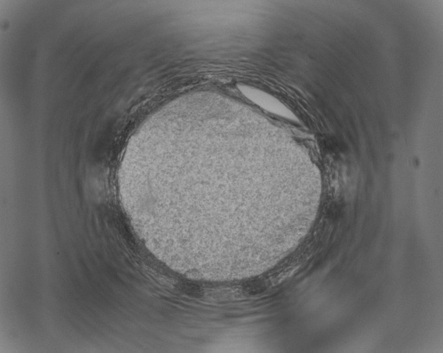 X0000067870511200605111803