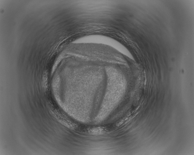 X0000067870600200605111801