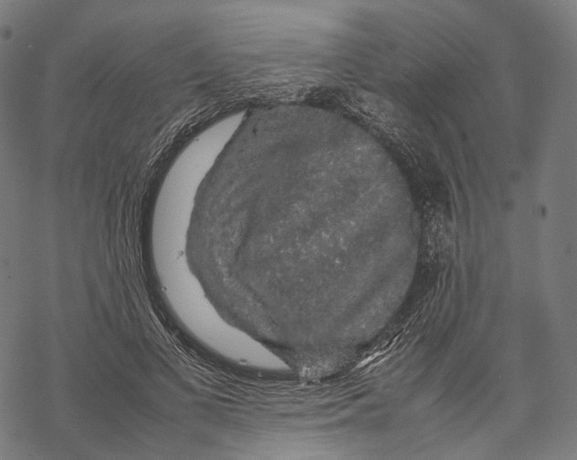 X0000067870693200605111800