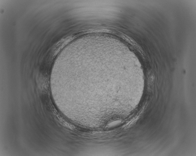 X0000067870985200605111755