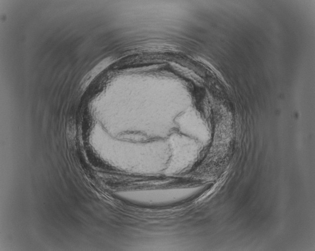 X0000067871065200605111754