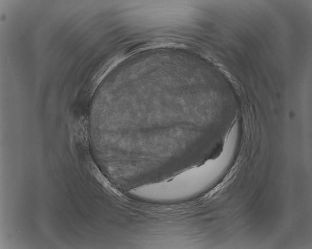 X0000067911369200605041632