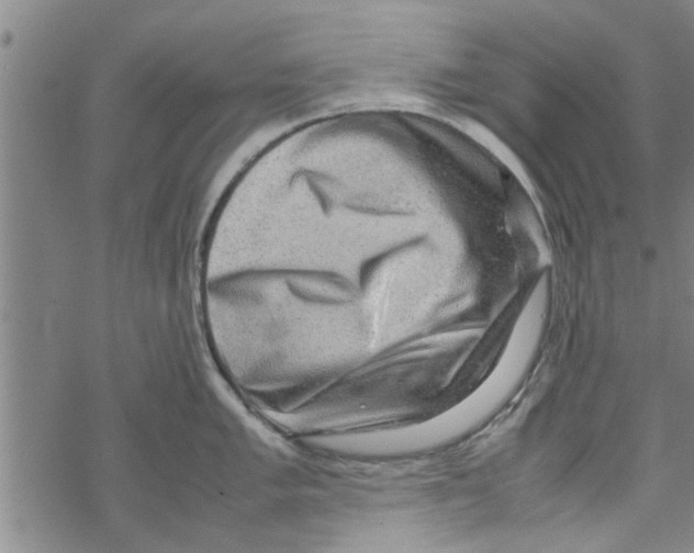 X0000067911005200605111938