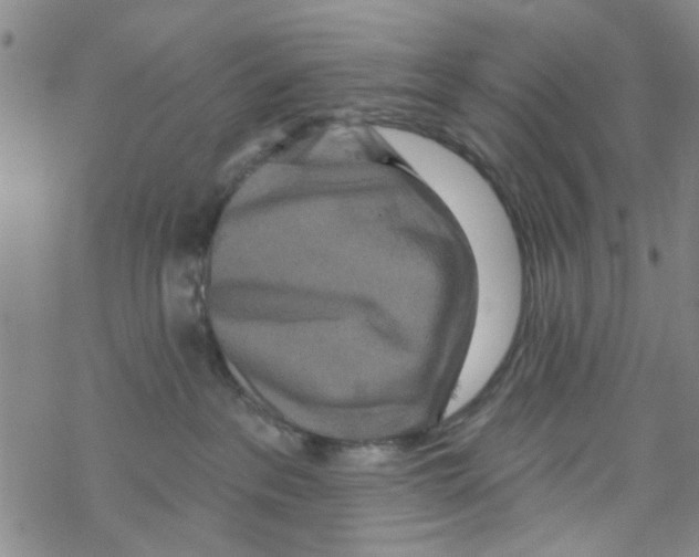 X0000067920237200605112016