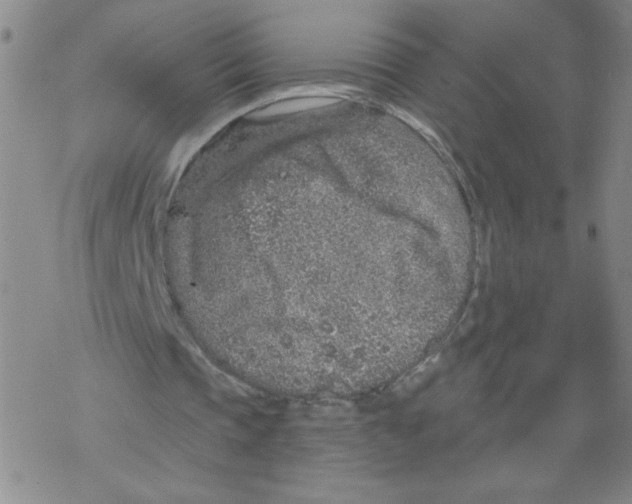 X0000067920337200605112014