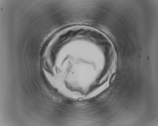 X0000067920346200605112014