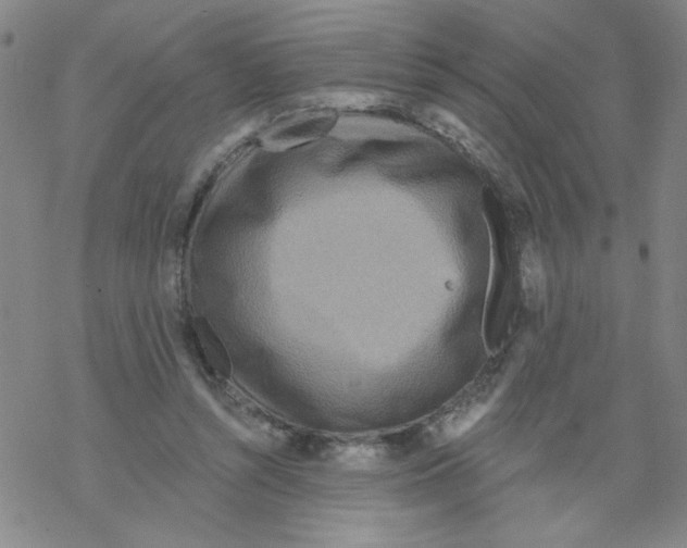 X0000067920352200605112014