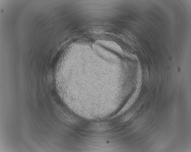 X0000067920367200605112014