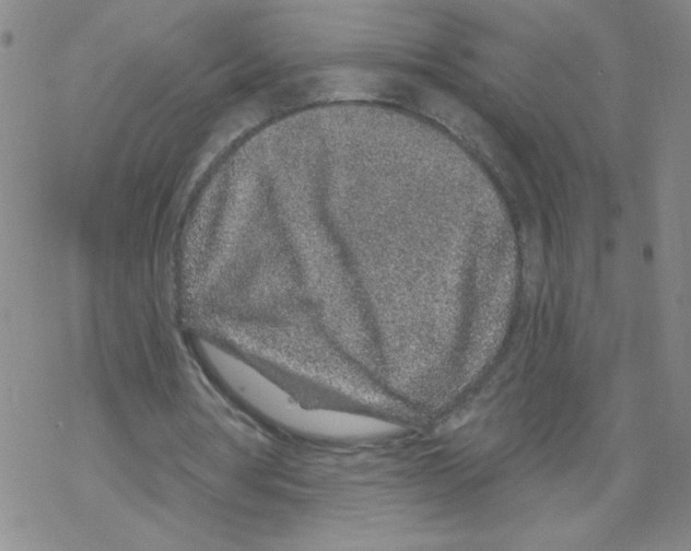 X0000067920386200605112014