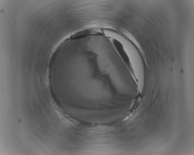 X0000067920387200605112014