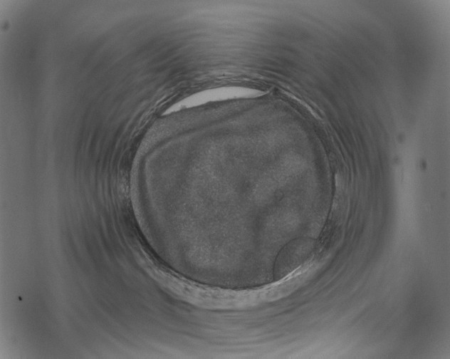 X0000067940048200605041811