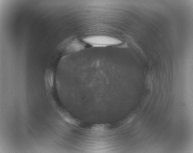 X0000068260076200605121831