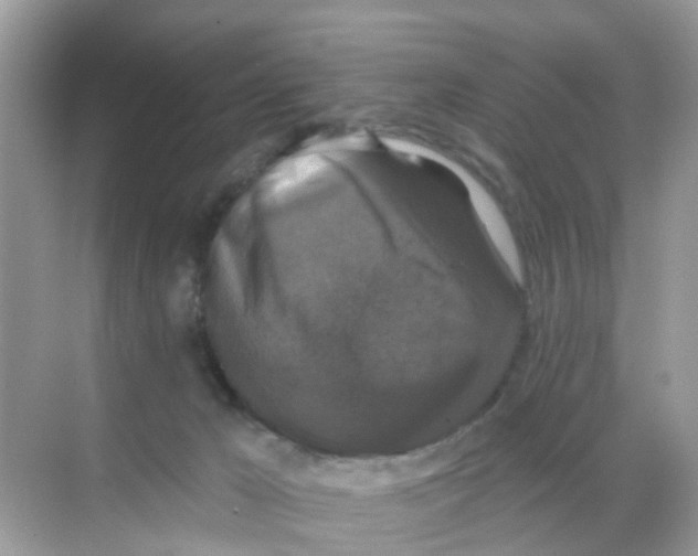 X0000068300029200605122015
