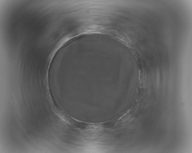 X0000068300099200605122014