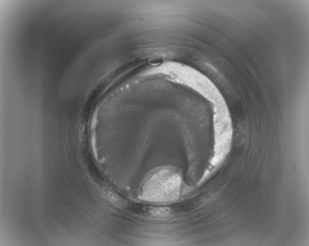X0000068300355200605122010
