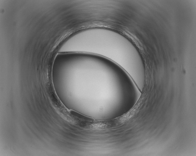 X0000068320158200604211020