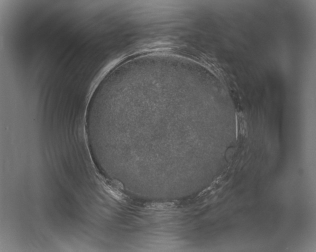 X0000068720147200605010942