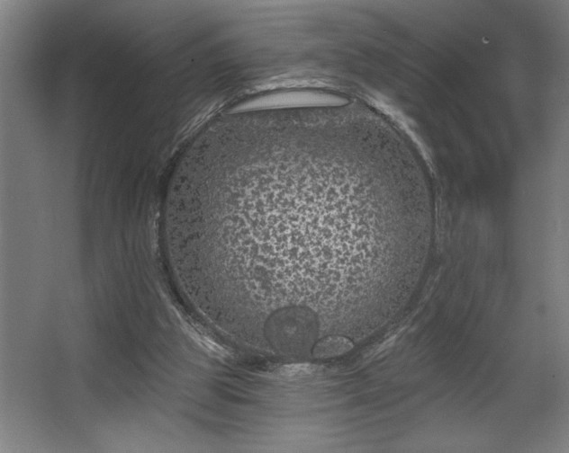 X0000068720153200605010942