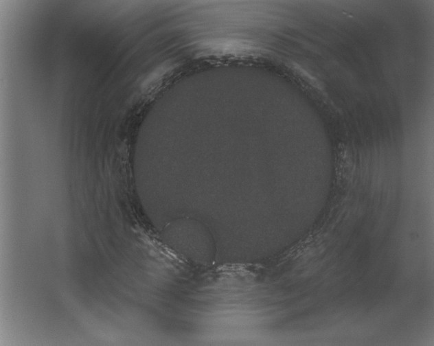 X0000068720918200605010929