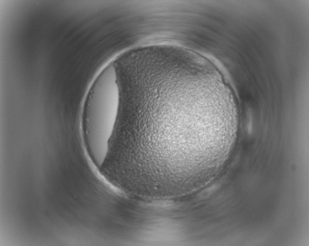 X0000068720957200605051430