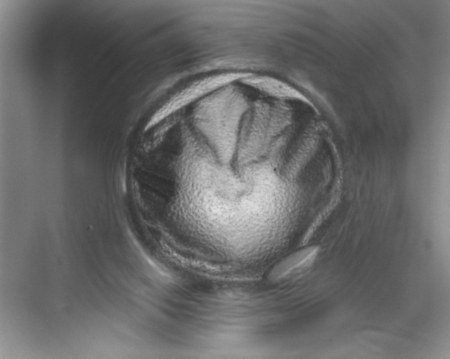 X0000068720062200605121503