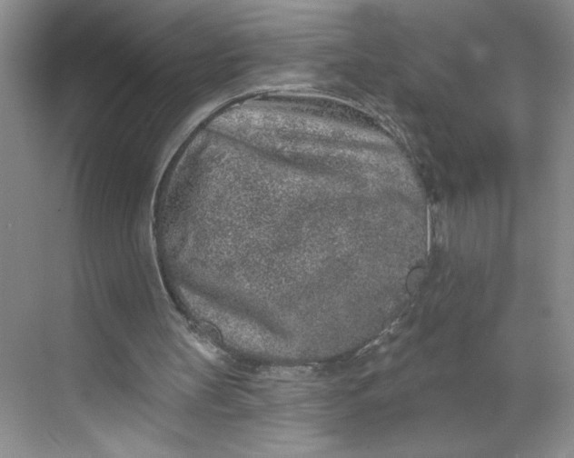 X0000068720147200605121501