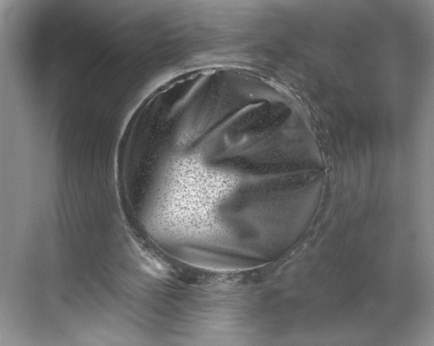 X0000068720148200605121501